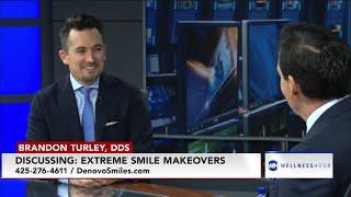 Extreme Smile Makeovers with Renton, WA dentist Dr. Brandon Turley