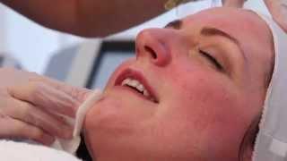 Skin Matrix offer the Peeling Act from Dr Jules Nabet range - Hear all about it on this video