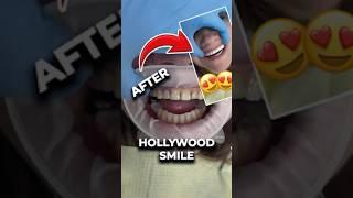 This Secret Behind Hollywood Smiles Will Shock You!
