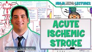 Acute Ischemic Stroke: Etiology, Pathophysiology, Clinical Features, Diagnostics, Treatment