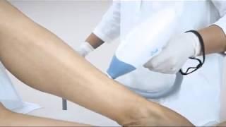 AsiroxInitiaIng - Laser Hair Removal - Lumiere Clinic