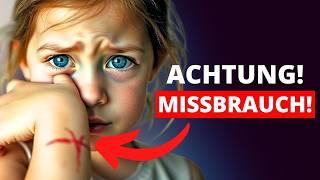 21 WARNZEICHEN! SO erkennst du sexuellen Missbrauch bei Kindern/Jugendlichen/Babys!