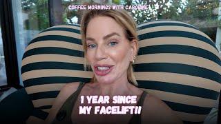 It has been 1 YEAR since my Facelift!!! what's my beauty secret?