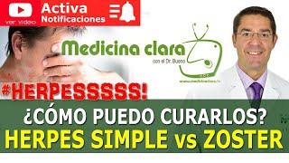 HERPES SIMPLE ️ HERPES ZOSTER. ¿CÓMO SE CURAN? TRATAMIENTO HERPES| Medicina Clara