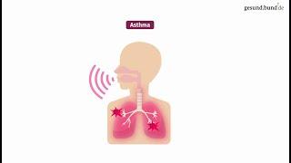 Was ist Asthma?