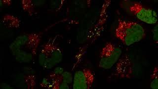 HeLa Cells