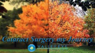 Cataract Surgery my Journey