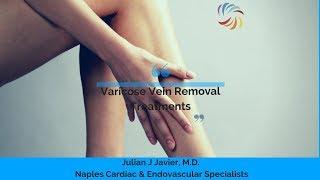 Get Rid of Varicose Veins with these Top 5 Treatments