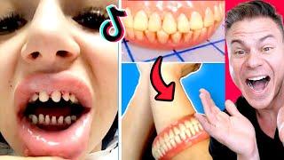 Amazing Tik Toks That Will Make You Want Braces