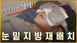 눈밑지방재배치 후기! 실명, 붓기 등 부작용 심할까?