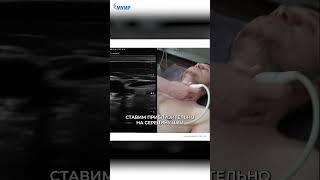УЗИ сосудов - это сложно? #узи #врач #медицина #обучение #доктор #здоровье #поликлинника #лечение