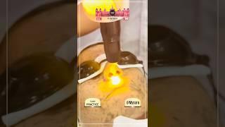 Laser Practice | V-Wonder Academy | Cosmetology | PMU | Dr Vidya Pradeep |