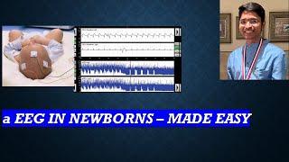 aEEG in Newborns - Made easy