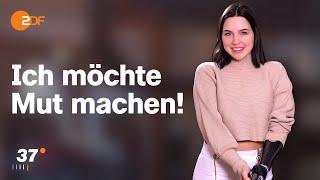 Nach Amputation: Gina will "Miss Germany" werden I 37 Grad