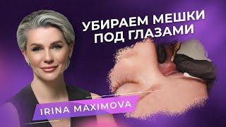 Camouflage of dark circles under the eyes. PMU Master Irina Maximova