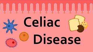 Celiac Disease and Gluten