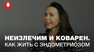 Коварный эндометриоз | Женское здоровье