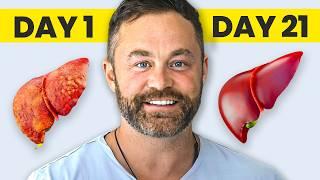 How to REVERSE your Fatty Liver (21 Day Complete Plan)