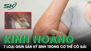 Cô Gái Bị 7 Loại Giun Sán Ký Sinh Trong Cơ Thể Do Thói Quen Ai Cũng Mắc Phải |SKĐS