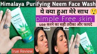 Himalaya Purifying Neem Face wash ll how to use ?pimple free face ll Buy or Not?#skincare#nainamlife