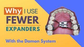 Why I Use Fewer Expanders with the Damon System