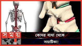 সব কোমর ব্যথাই কি সায়াটিকা? | Sciatica | Pain | Treatment | Advise | Somoy TV