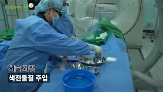 전립선비대증 시술과정 (휴먼영상의학센터 전립선동맥색전술) BPH treatment procedure (HUMIC PAE)