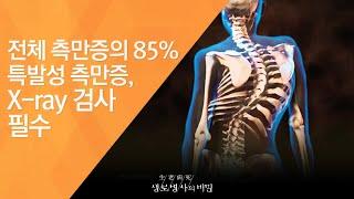 전체 측만증의 85% 특발성 측만증, X-ray 검사 필수 - (2011.4.2_367회 방송)_내 몸의 기둥, 척추