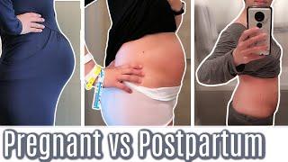 Post C-Section Belly Progression | 24 Hours to 7 Weeks |  JAKS Journey