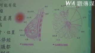 我的乳房到底怎麼了？　醫師張純萍提建議免貽誤病情