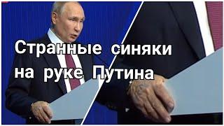 Странные синяки на руке Путина