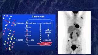 Molecular Imaging of Cancer for the Lay Person