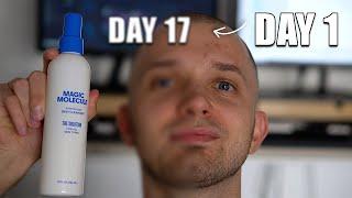 Magic Molecule Spray 17 Day Review - Before & After Using Hypochlorous Acid 3-4 Times A Day!