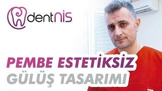 Pembe Estetik Yapılmadan Gülüş Tasarımı Uygulanabiliyor Mu?