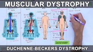 Muscular Dystrophy | Types and Mutations