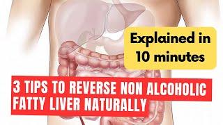 3 Tips to Reverse Non-Alcoholic Fatty Liver Naturally : Explained in 10 minutes | Wellness Munch