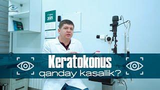 Keratokonus qanday kasallik? | Dr.zohidjon