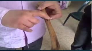 Dr.Ayman Abdallah - Bones of Upper Limb