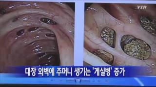 '게실병' 환자 늘고 있다…'식생활 돌이켜보세요' / YTN