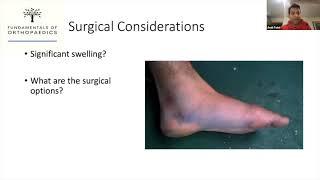 Fundamentals of Orthopaedics Session 15 Part 3 - Lis Franc