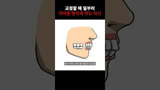 교정하고 있는데 왜 치아가 더 이상 해지죠? #shorts