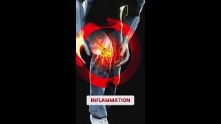 Anti-Inflammatory Drug Offers Hope | Breakthroughs Can't Wait