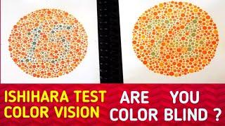 Ishihara Test| Colour Blind Test|Colour Vision Test| Colour Blindness Book