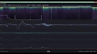 ZLab Sleep Study Management Software demo