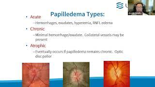 Clinical Grand Rounds in Optic Neuropathies: “You’ve Got Some Nerves!”