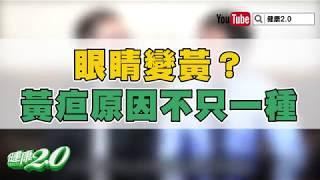 【暖醫在線】黃疸是肝病警訊？醫師打破迷思：原因不只一種！