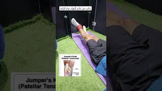 جانب من علاج التهاب الركبة