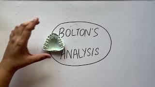 "Bolton's Analysis in Orthodontics: A Comprehensive Overview"