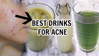 CLEAR YOUR ACNE WITH THESE TOP 6 DRINKS FOR ACNE AND PREVENTION || Healing the gut, digestion, etc.