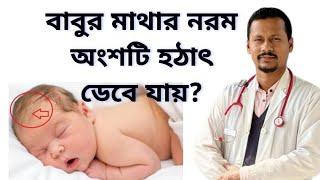  বাবুর মাথার নরম অংশ হঠাৎ ডেবে যায় কেনো?  Dr.sofiqul Islam